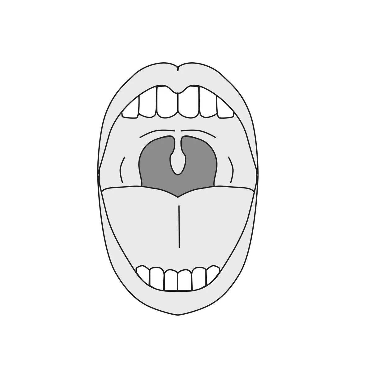 A mouth held wide open, showing the tonsils and the back of the throat